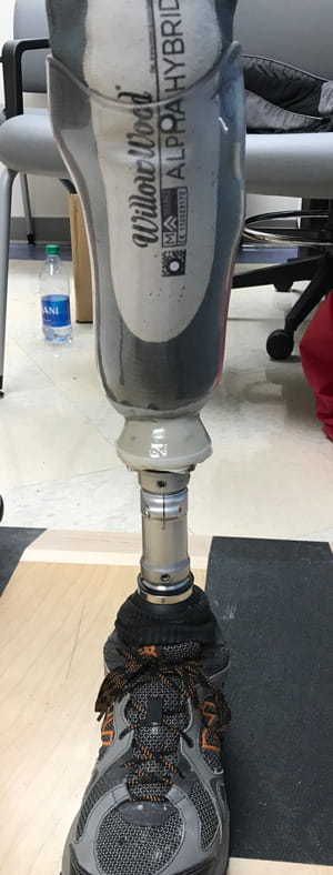 Example of a prosthetic leg