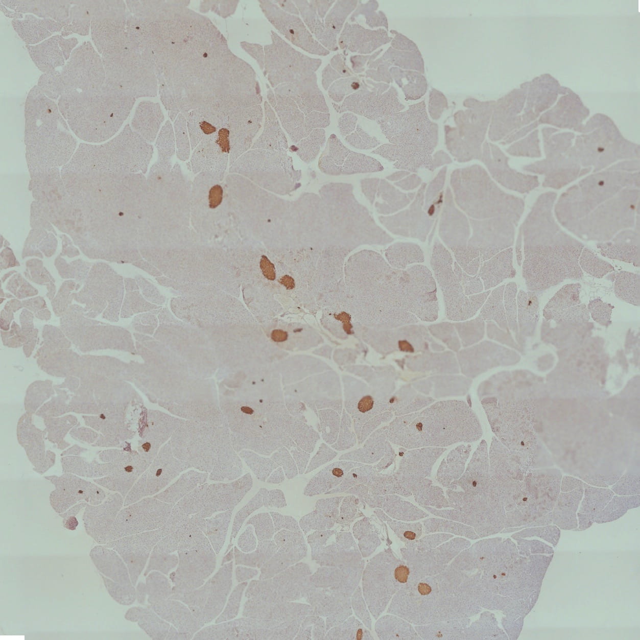 An image taken from a microscope. 