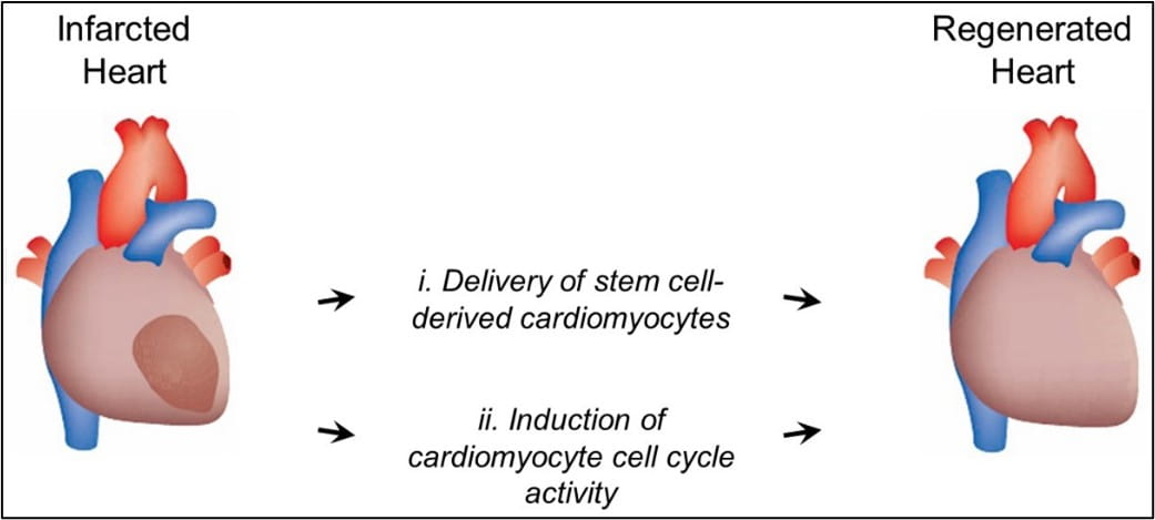 Illustration of infarcted heart and regenerated heart, showing the process of the delivery of stem cell-derived cardiomyocytes and induction of cardiomyocyte cell cycle activity. 