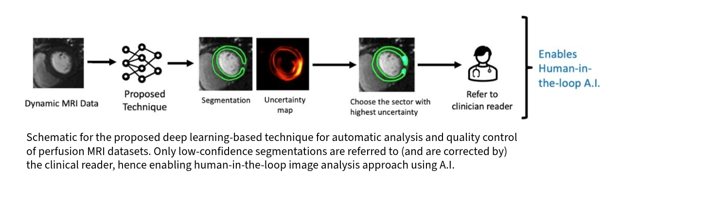 This publication illustration shows a schematic for proposed deep learning-based technique for automatic analysis and quality control of perfusion MRI datasets.  From left to right: Dynamic MRI data, proposed technique, segmentation, uncertainty map, choose sector with highest uncertainty and refer to clinical reader. This enables Human-in-the-loop artificial intelligence.