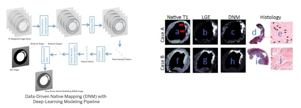 graphic from this publication shows data driven native mapping with a deep-learning modeling pipeline