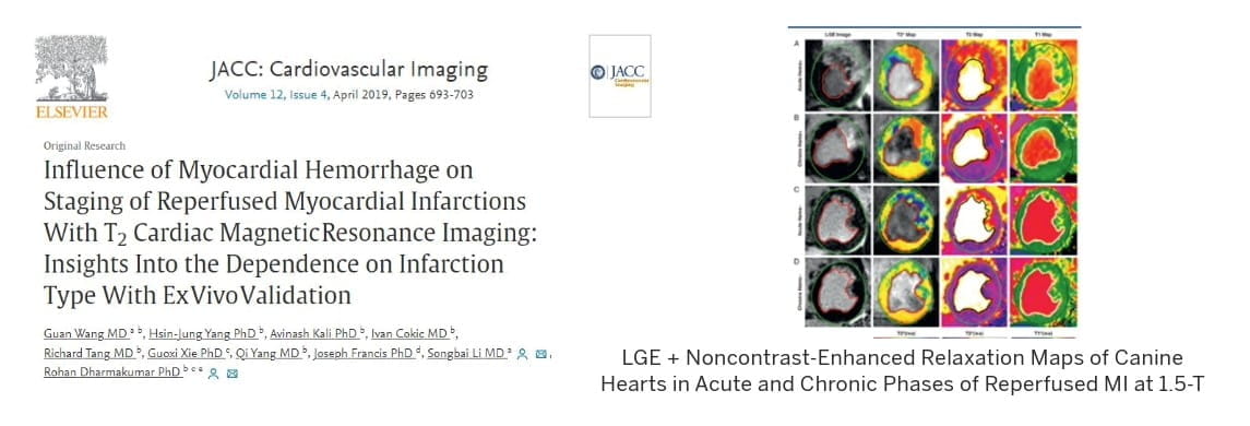 graphic from this publication shows LGE + noncontrast-enhanced relaxation maps of canine hearts in acute and chronic phases of reperfused MI at 1.5-T