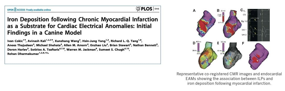 graphic from this publication shows imaging scans of the association between ILPs and iron deposition following myocardial infarction