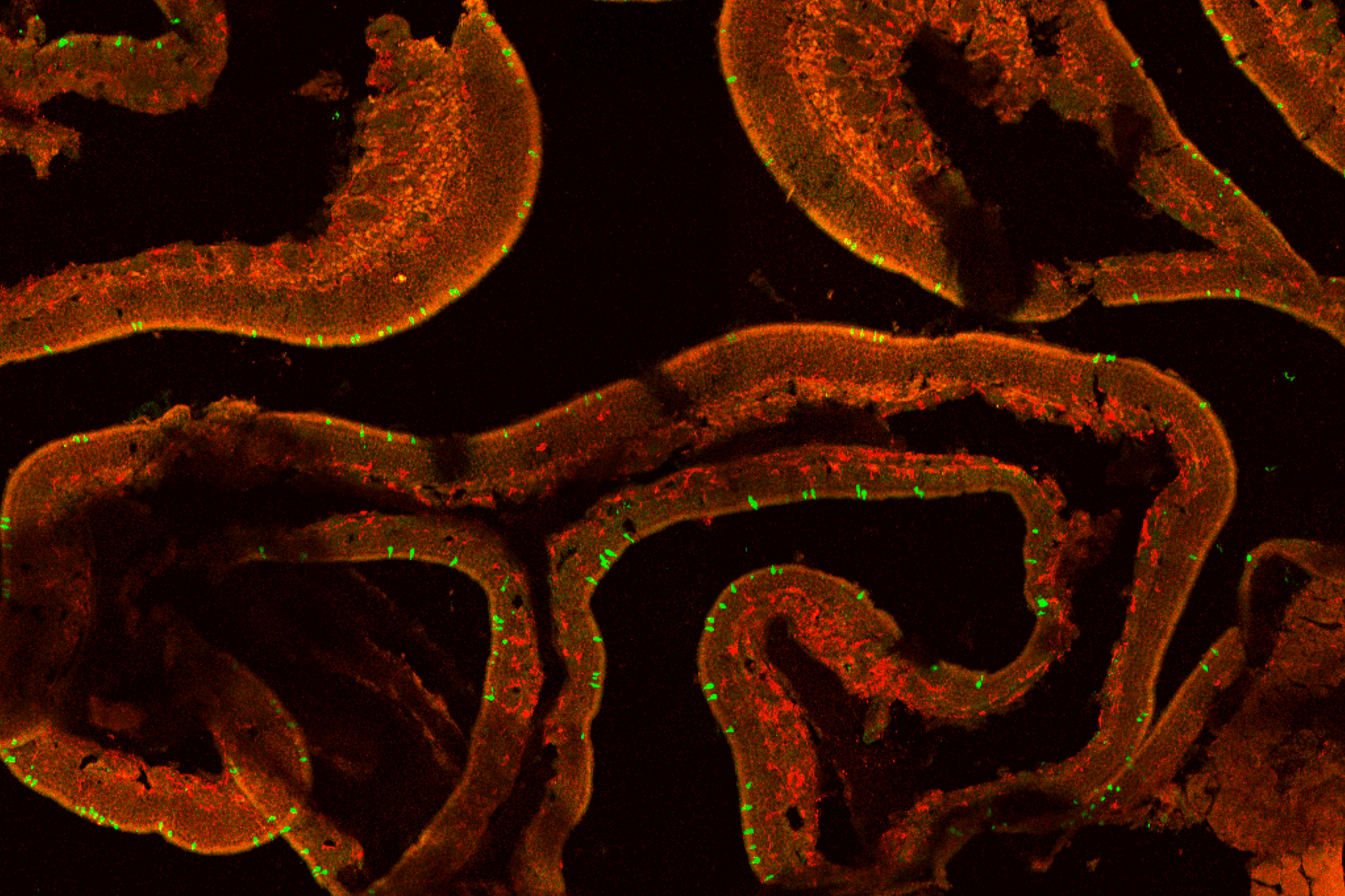 black and orange inflammation image
