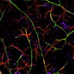 Colorful scan showing VCID