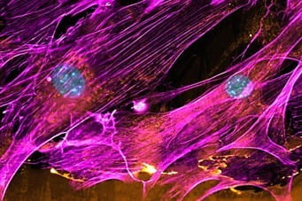 imaging of tissues in bright purple with yellow and blue spots