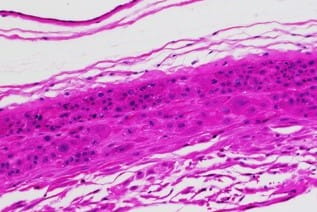 human gestational membrane immunohistochemistry H&E