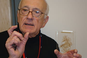 Physician holding sample of brain slice.