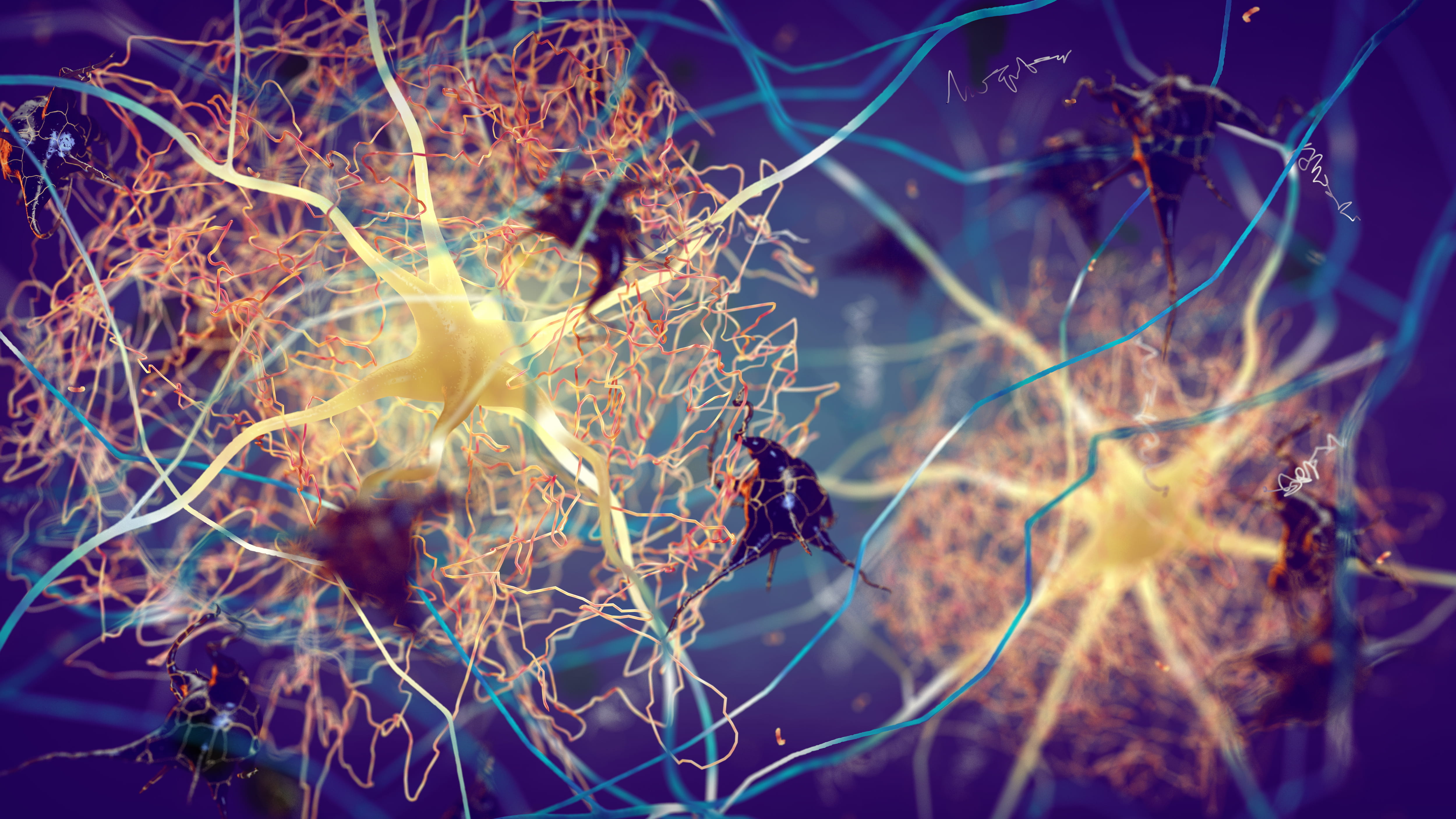 Alzheimer's disease nerve cells