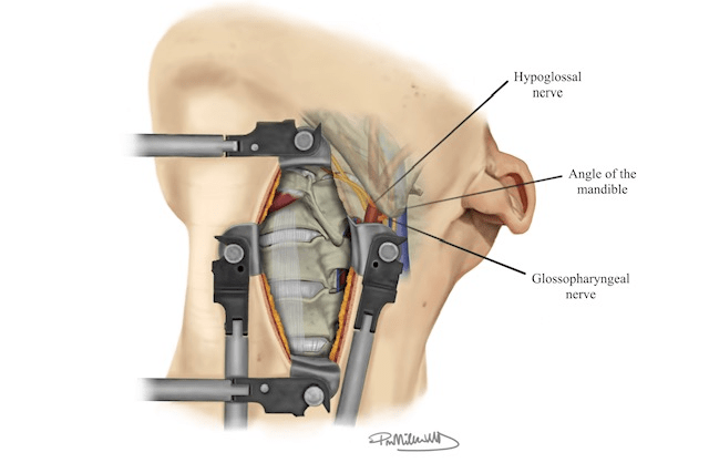 Payton Miller biomedical visualization image