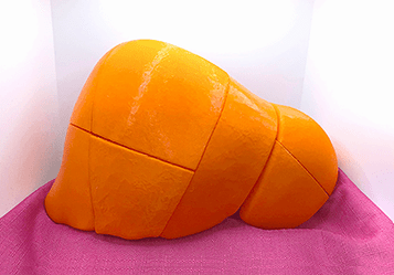 3D-printed segmented liver model (front view)