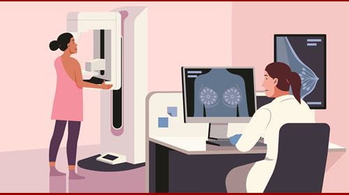 Illustration of a mammogram. ST.art - stock.adobe.com Illustration of a mammogram
