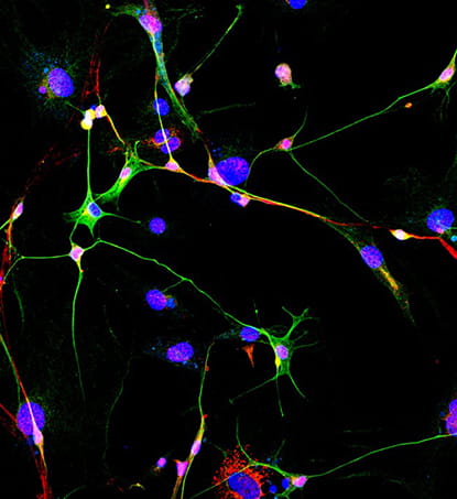 Conversion of fibroblast to induced neuronal cells at 4 weeks post nanoelectroporation