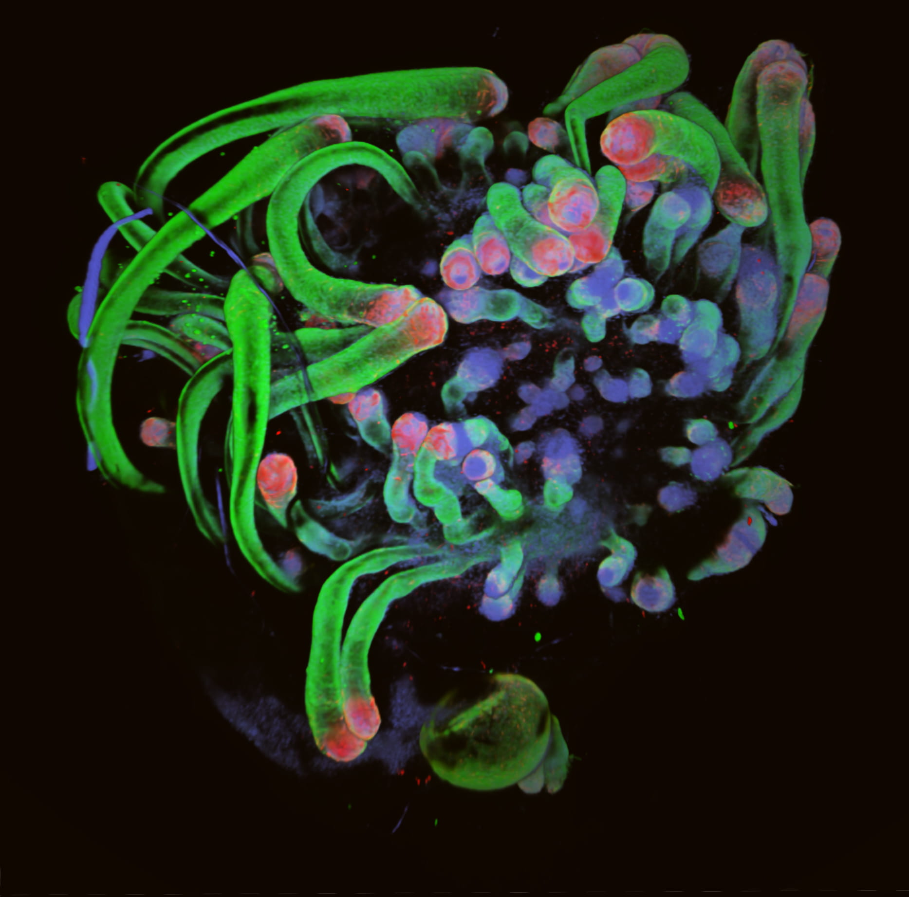 ENT hairy skin growth human stem cells