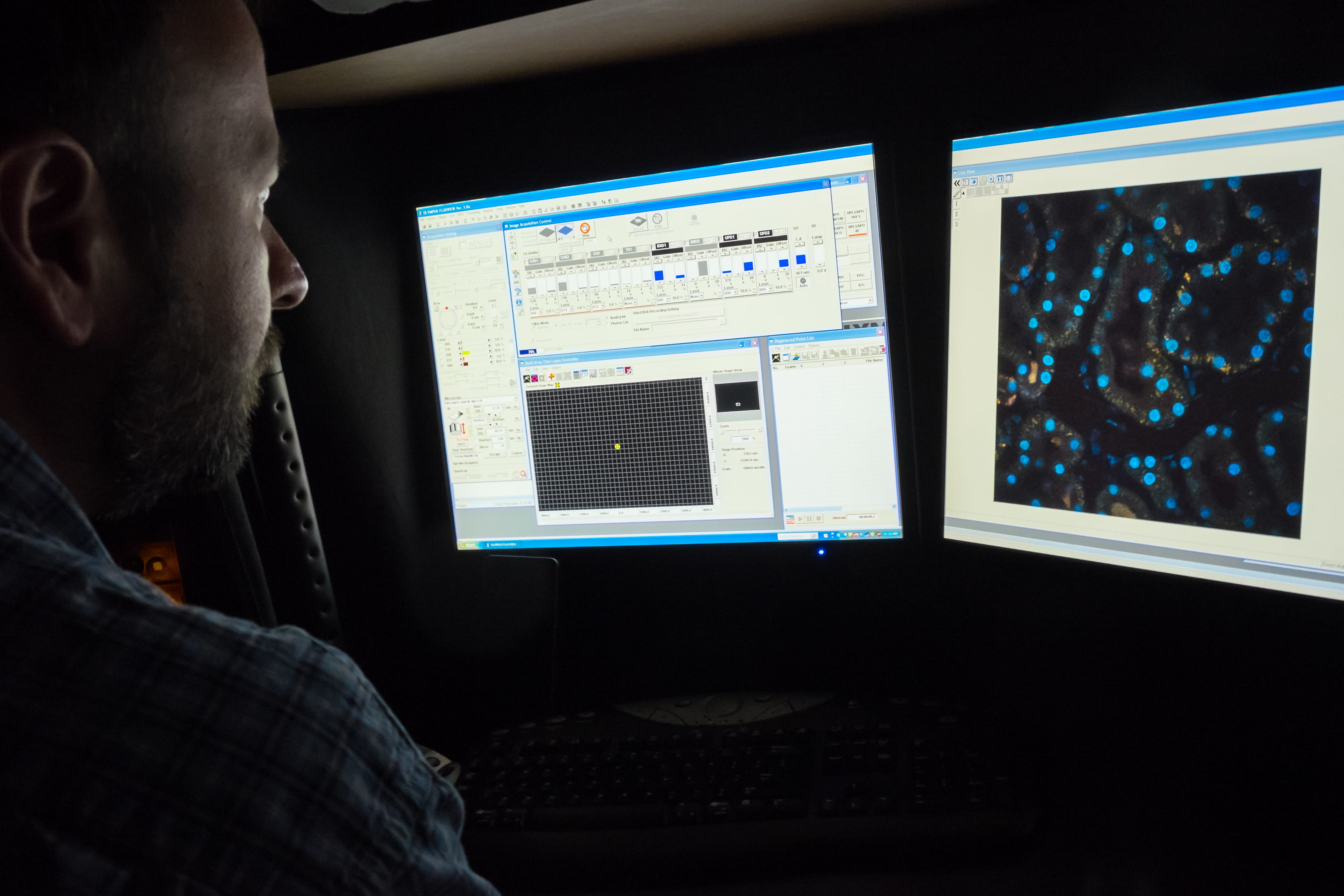 Eli Lilly CTSI autoimmune diseases