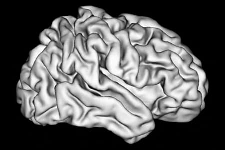 scan of brain folding