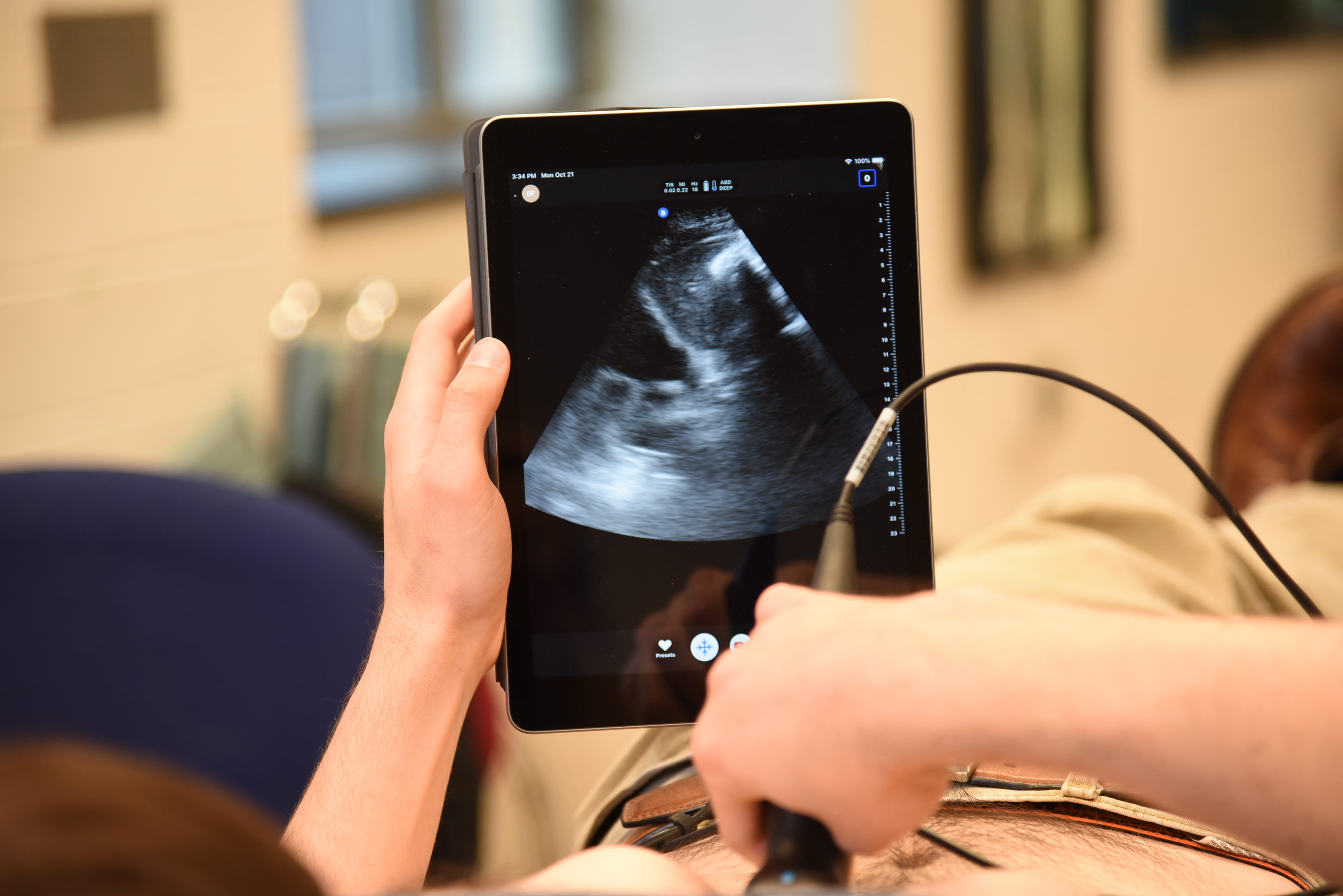 a close up photo shows hands holding a display screen and a POCUS wand against a patient's stomach