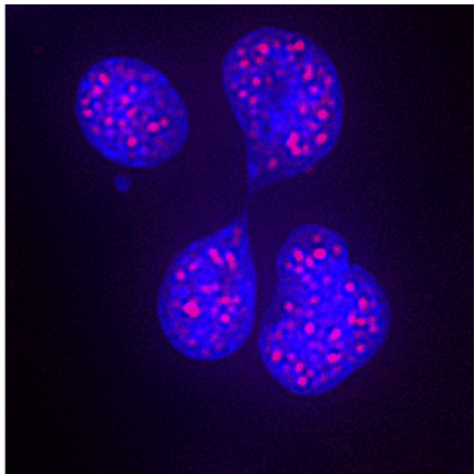 Katerndahl Lab Images