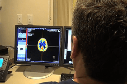 Individual looking at brain scans on a computer screen