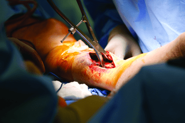 Orthopaedic Trauma Call Responsibility